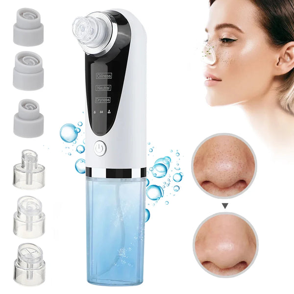 Electric Blackhead Remover Pore Vacuum – USB Rechargeable Face Cleaner with Water Cycle for Deep Pore Cleansing and Acne Care