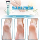 Wireless Electric Foot Grinder - Callus Remover & Dead Skin Exfoliator